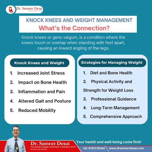 Knock knee treatment