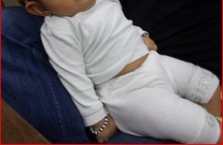 Best Pulled-elbow treatment in Pune