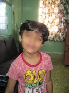 Best Torticollis Treatment in Pune