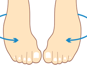 Best Clubfoot treatment in Pune